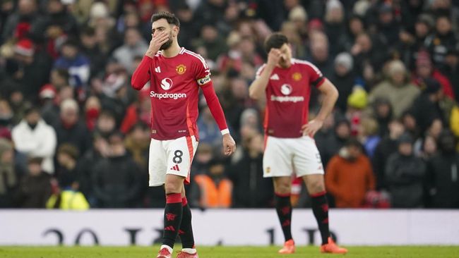MU Kehilangan Percaya Diri Setelah Kalah dari Brighton