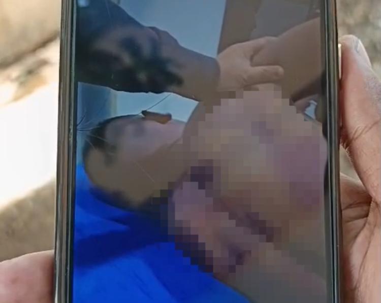 RS Bhayangkara Polda Kepri tempat korban polisi muda diperiksa